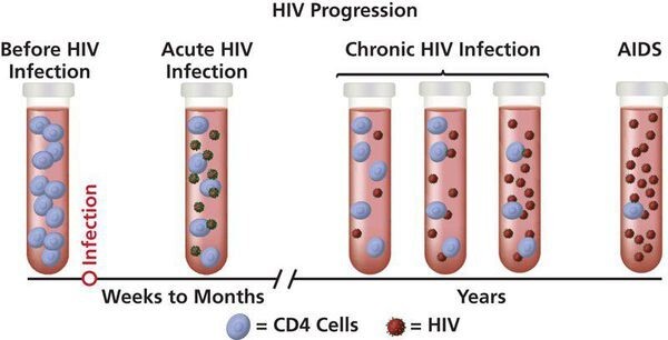 ВИЧ-инфекция
