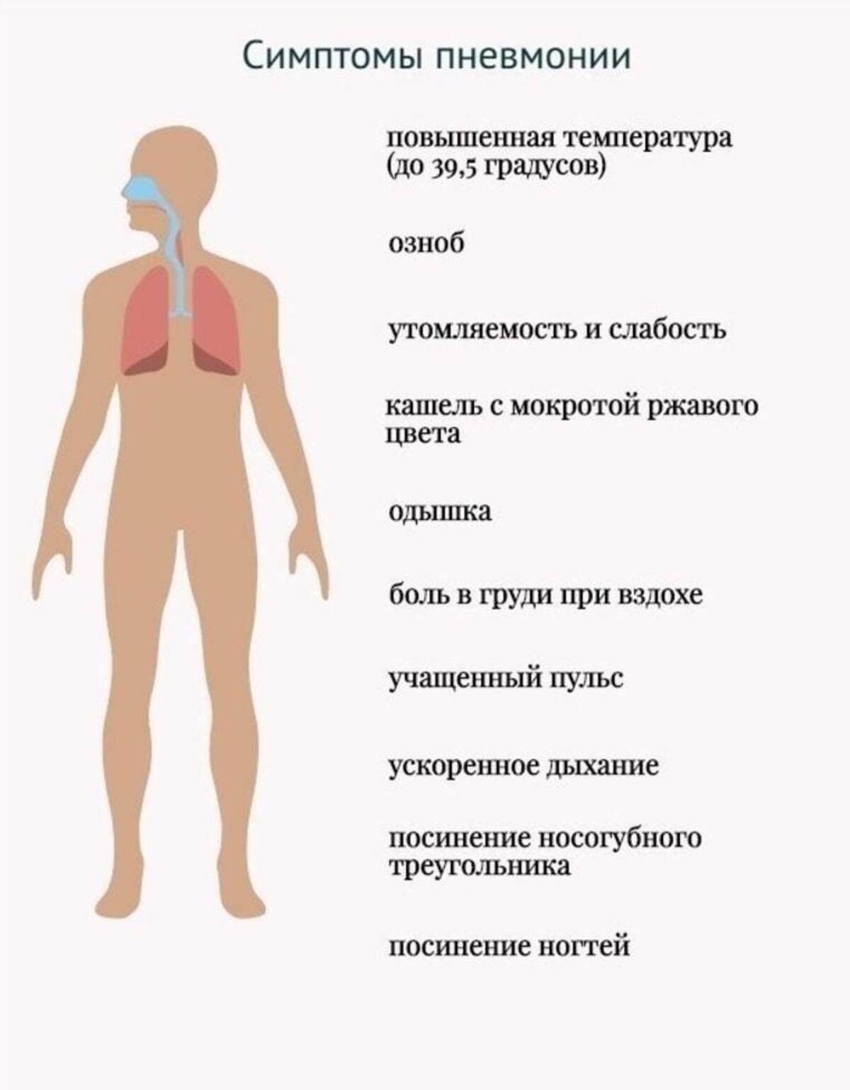 Пневмония симптомы
